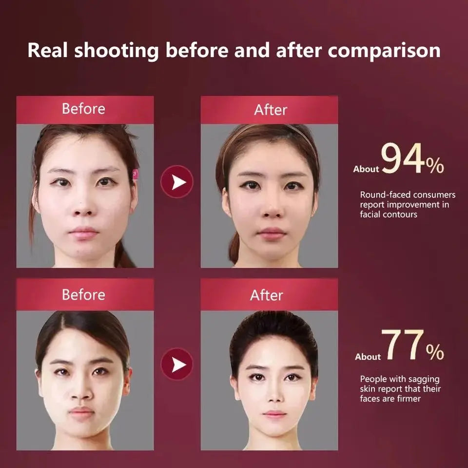 LED Photon Therapy Facial Lifting Massager